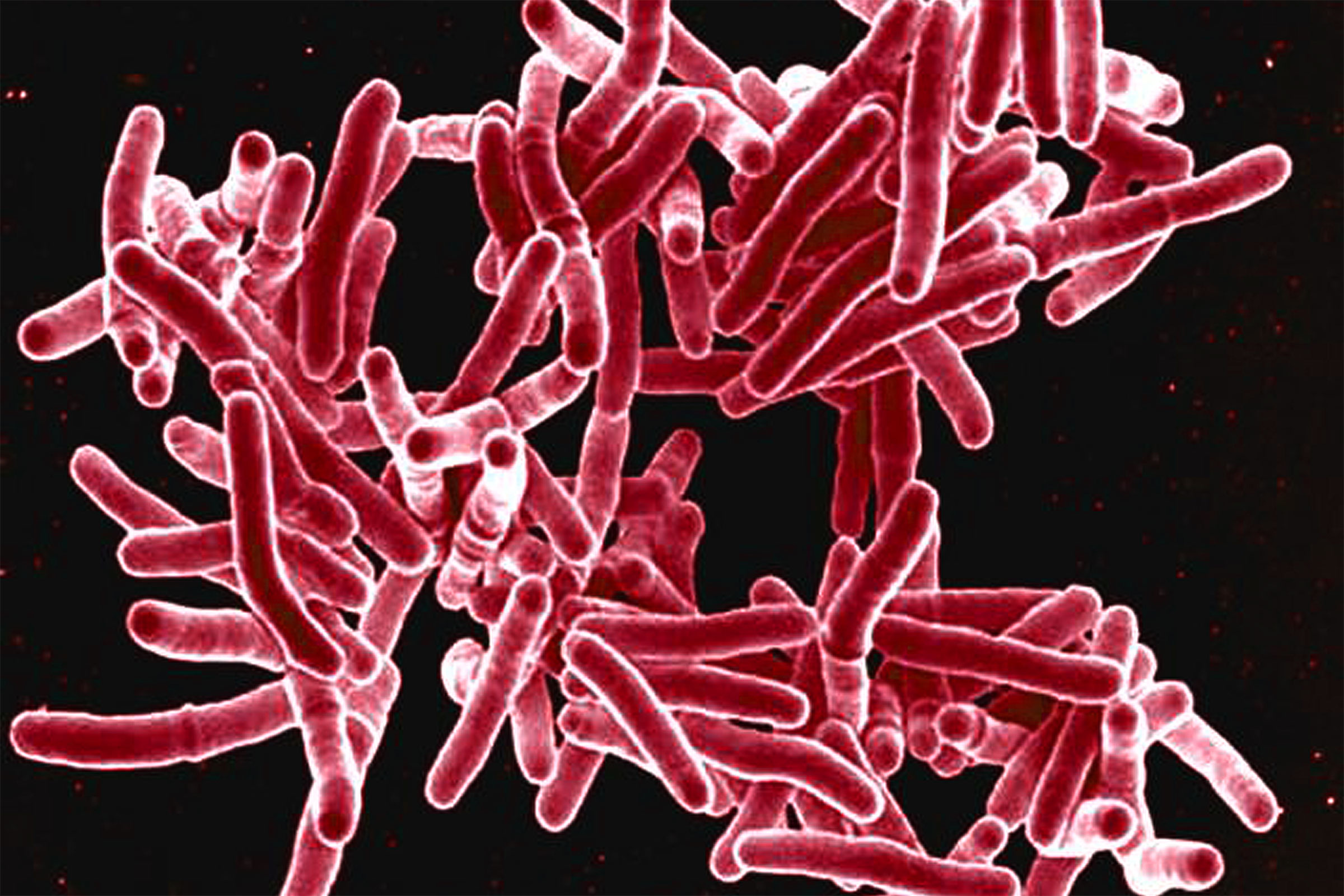 False colored micrograph of Mycobacterium tuberculosis